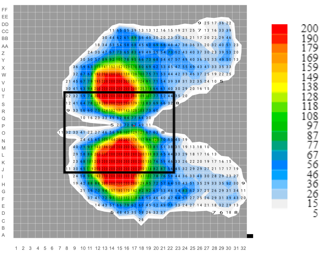 Sitzdruckverteilung ohne Healthfix Sitzkissen